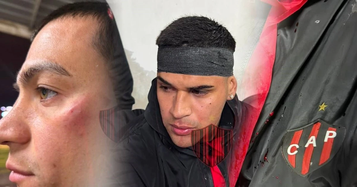 Agresión a futbolistas de Patronato tras derrota ante Colón en la Primera Nacional