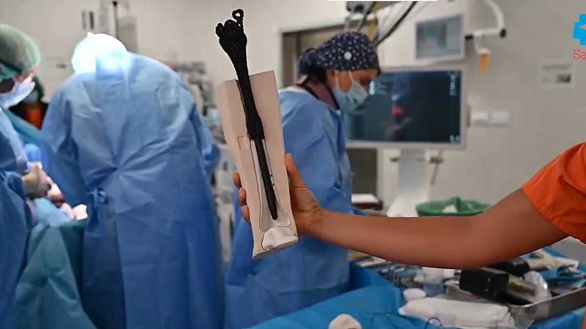 El Hospital Gregorio Marañón implanta la primera prótesis ósea metamaterial personalizada